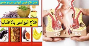 علاج البواسير تكفون