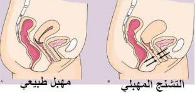 ضيق فتحه المهبل اثناء الحمل - تعرفى عن معلومات اثناء الحمل 609 3