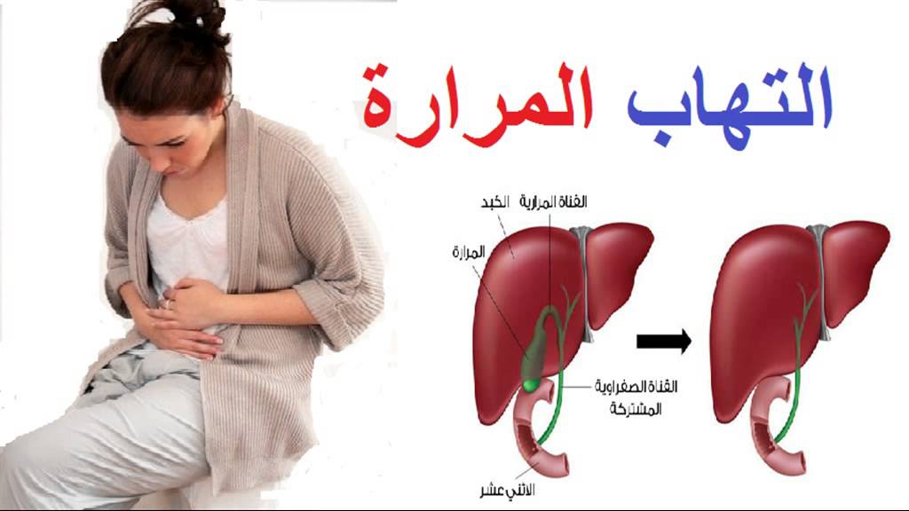 اعراض المرارة , اسباب تهيج المراره