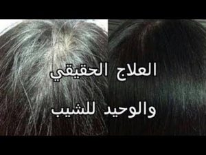 لقيته لقيته سبب الشيب وعلاجه باذن الله