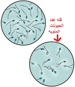 للزوج الي عنده صفر او تشوة او مشكلة في الحيوان المنوي مهم